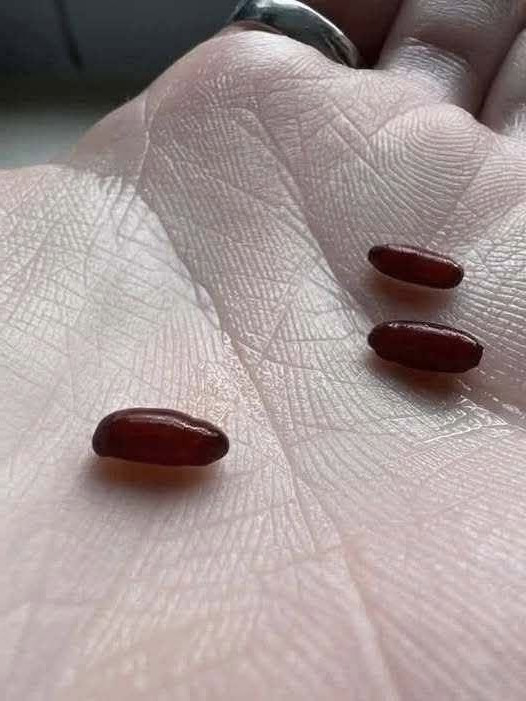 Maladie de Lyme, fièvres, infections : le guide essentiel pour se protéger des tiques en famille