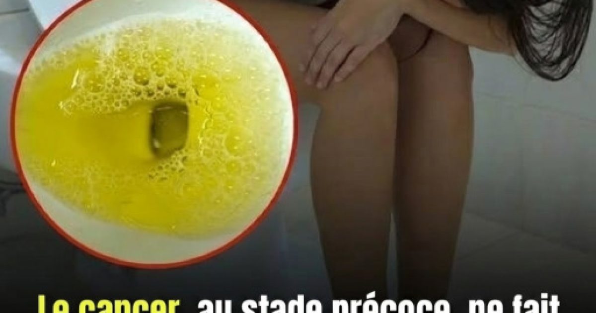 Ces 6 signaux aux toilettes que votre corps vous envoie et qu'il ne faut surtout pas ignorer