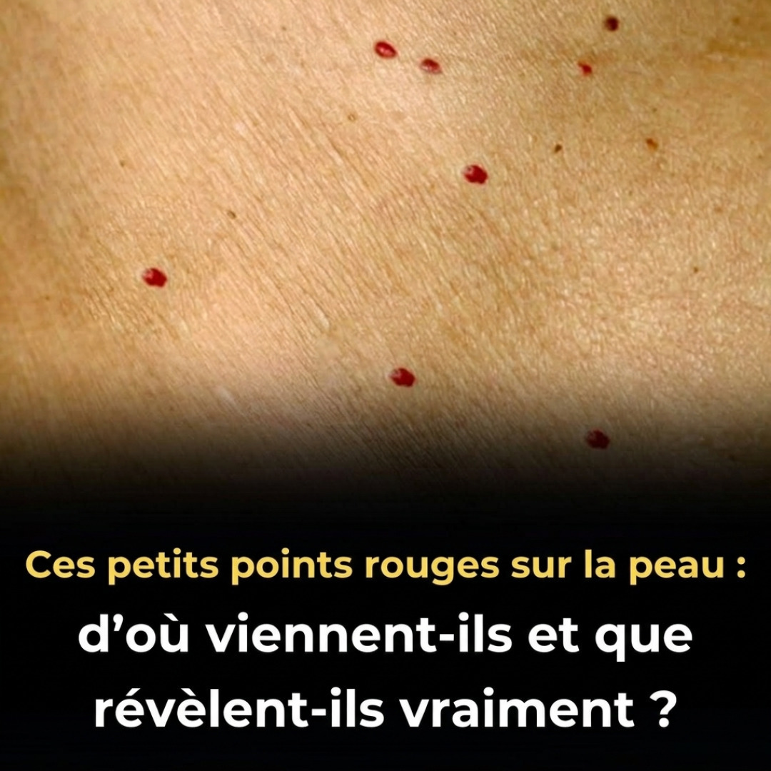 Ces points rouges sur la peau : ce qu'ils révèlent vraiment sur votre santé