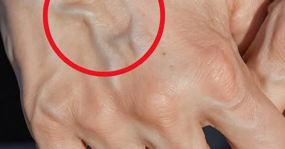 Veines apparentes : ce que votre corps essaie vraiment de vous dire