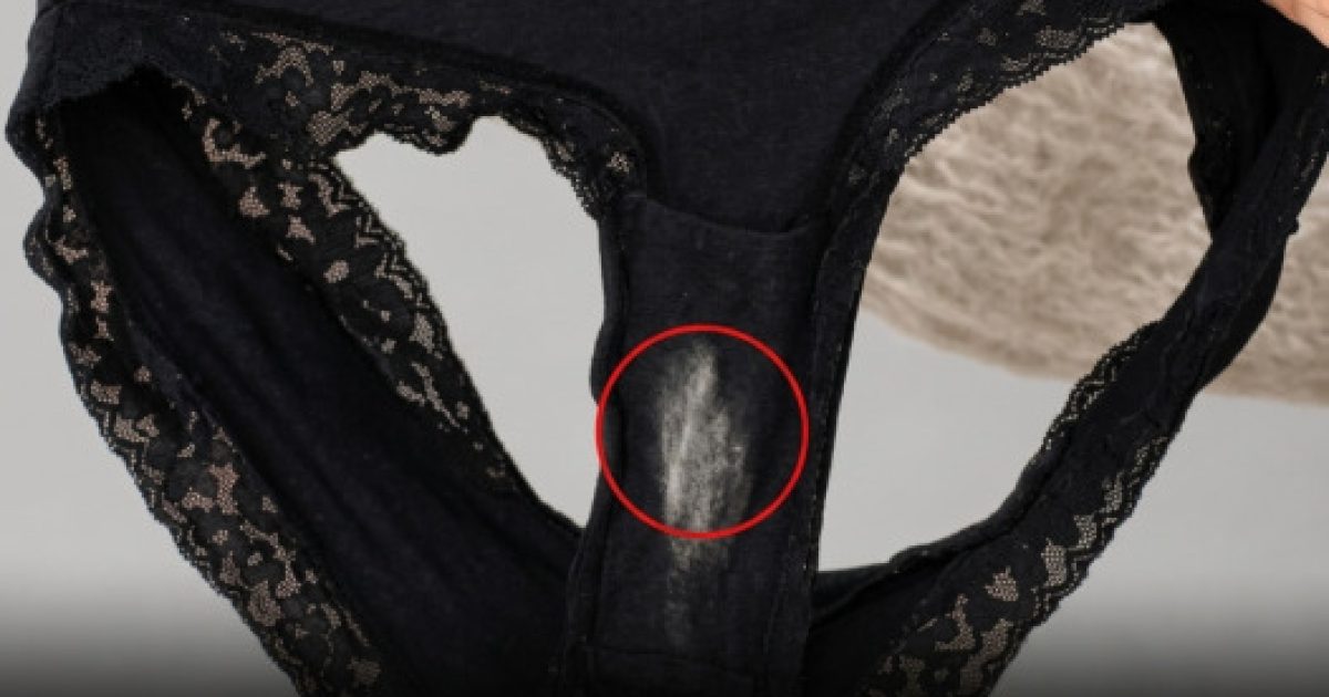 Ces mystérieuses taches claires sur vos sous-vêtements ? Voici ce qu'elles révèlent vraiment