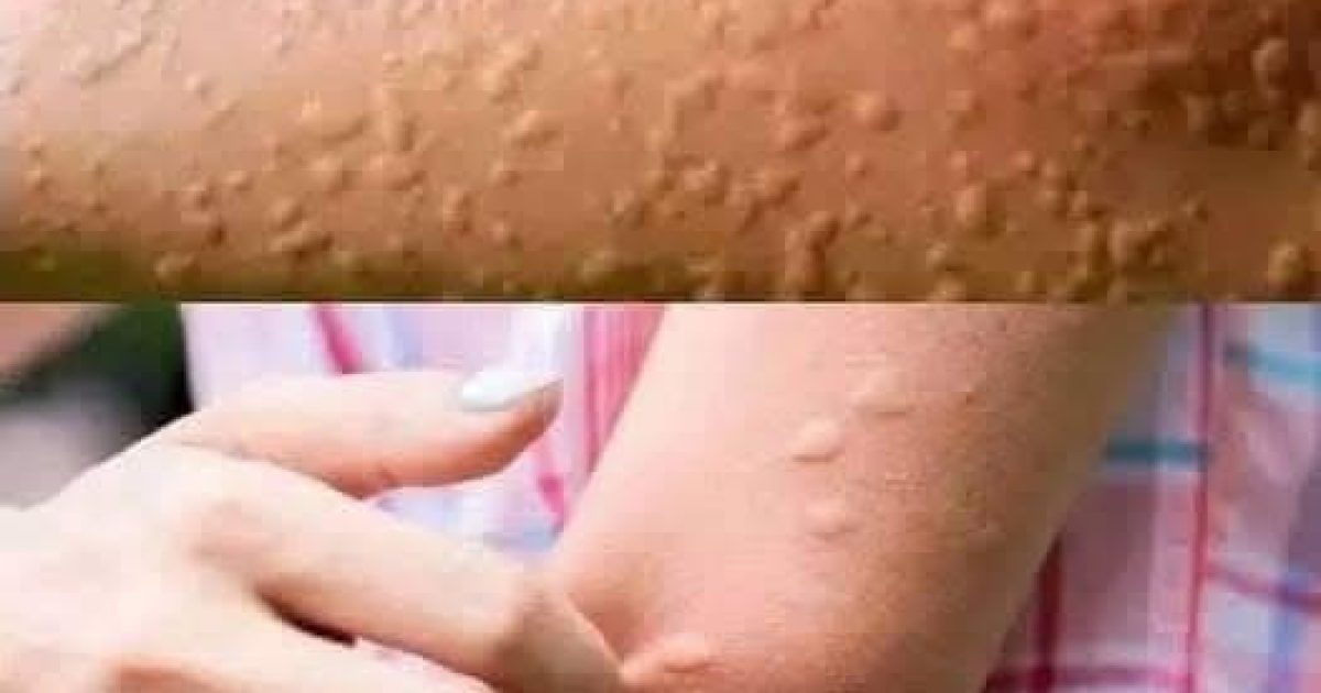 Elle pensait avoir une allergie : ce que cachaient vraiment ses démangeaisons va vous surprendre