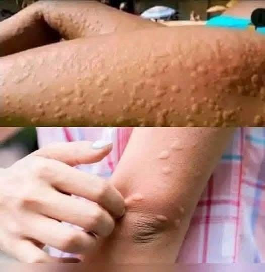Elle pensait avoir une allergie : ce que cachaient vraiment ses démangeaisons va vous surprendre
