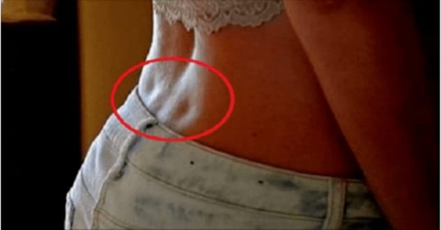Ces deux creux dans le bas du dos : que cachent-ils vraiment ?