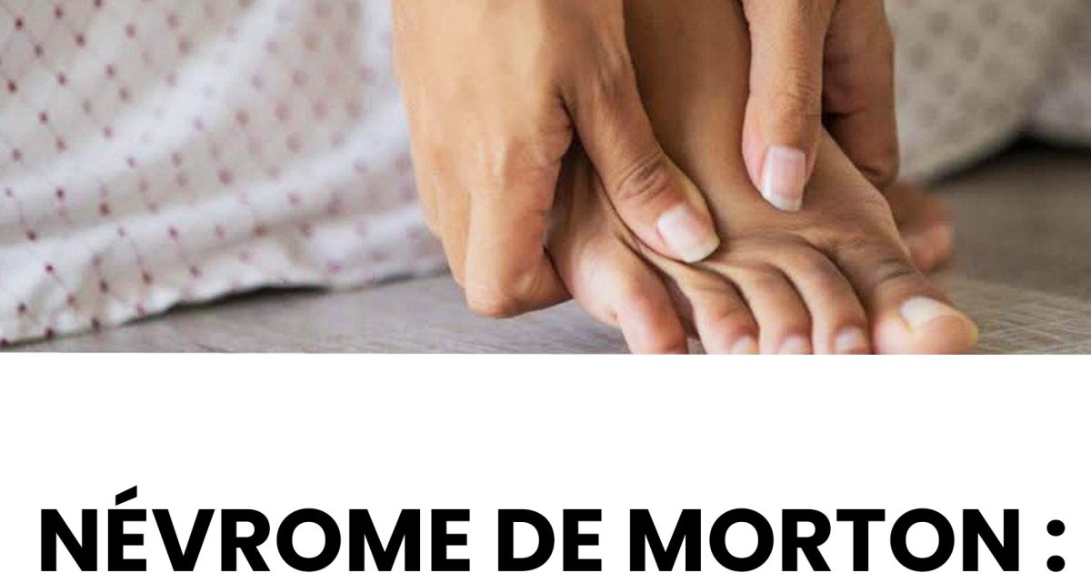 Névrome de Morton : comprendre cette douleur vive au pied