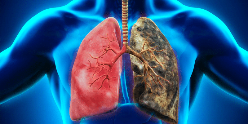 Graphique sur l'évolution des cancers