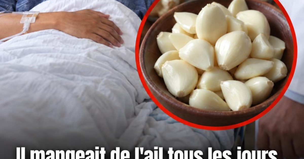 Il mangeait de l'ail chaque jour depuis 5 mois : les résultats ont surpris ses médecins