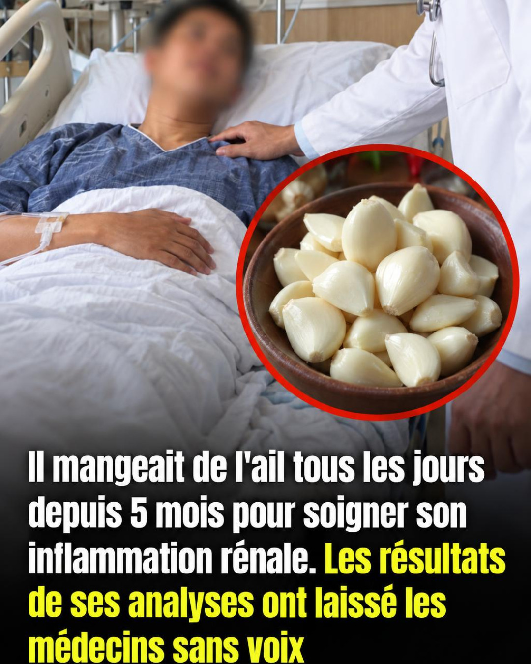 Il mangeait de l'ail chaque jour depuis 5 mois : les résultats ont surpris ses médecins
