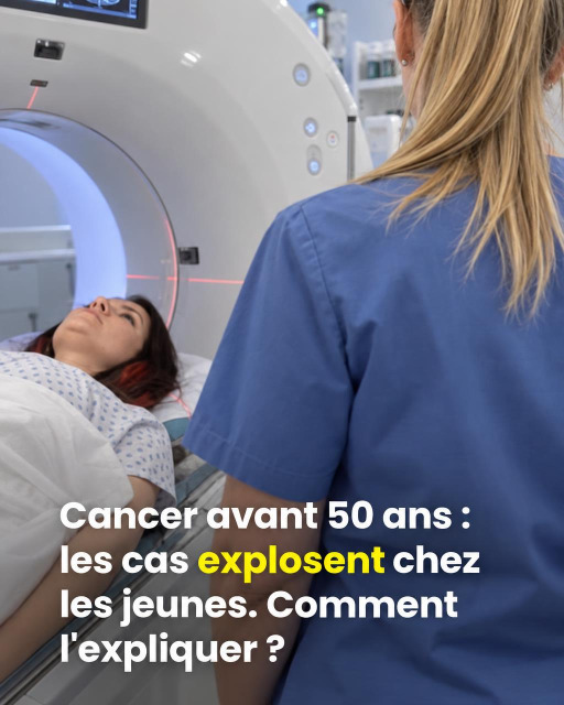 Cancer avant 50 ans : pourquoi les cas augmentent et comment mieux se protéger