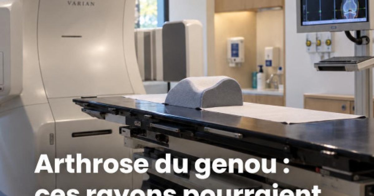Arthrose du genou : la radiothérapie à très faible dose pourrait changer la donne avant la prothèse