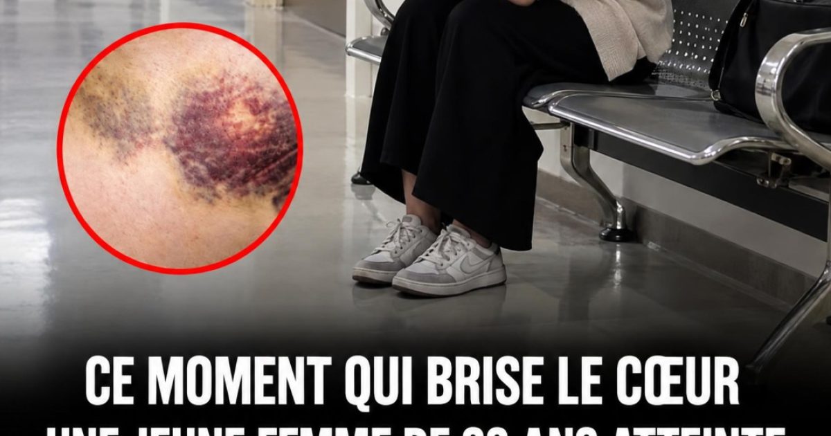 Leucémie : les signes avant-coureurs que personne ne devrait ignorer, même à 23 ans
