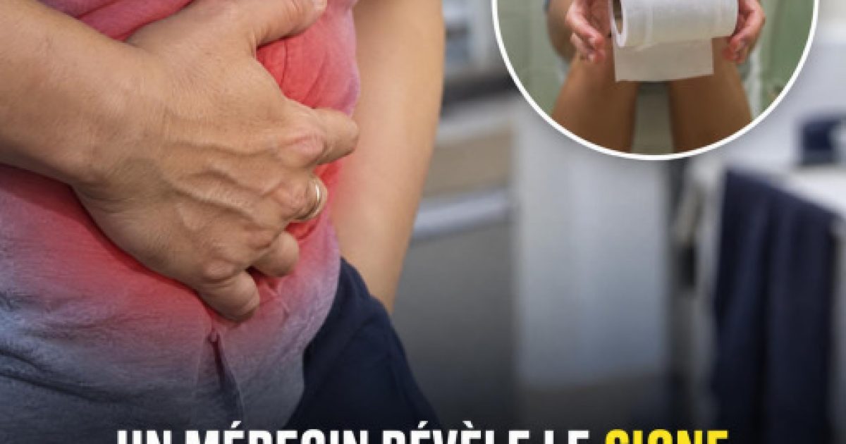 Cancer colorectal : ce signe discret que beaucoup confondent avec un simple problème digestif