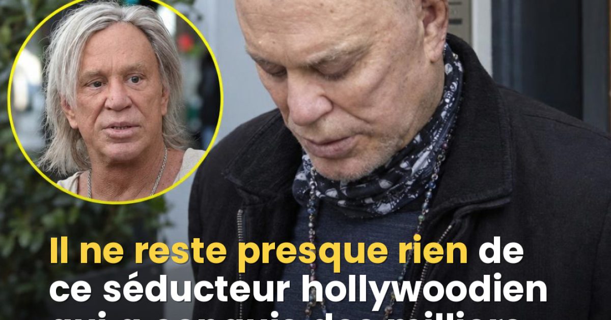 Mickey Rourke : comment l'obsession de la chirurgie esthétique a transformé l'une des plus grandes icônes d'Hollywood