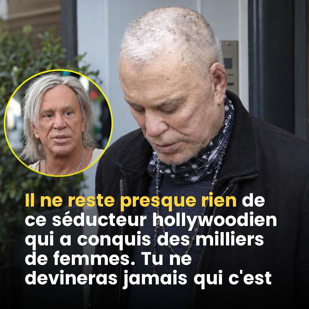 Mickey Rourke : comment l'obsession de la chirurgie esthétique a transformé l'une des plus grandes icônes d'Hollywood