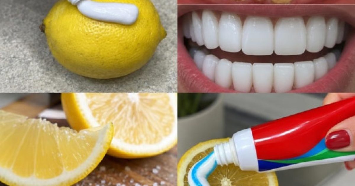 Dents jaunies : la méthode naturelle qui éclaircit votre sourire en une heure chrono