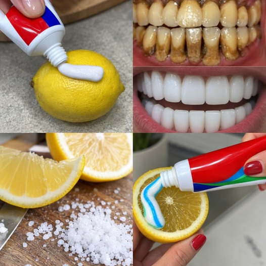 Dents jaunies : la méthode naturelle qui éclaircit votre sourire en une heure chrono