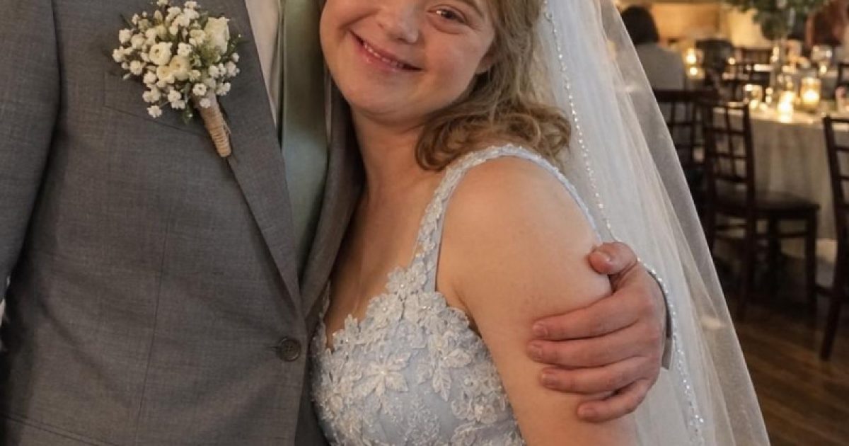 Il a épousé sa meilleure amie atteinte de trisomie 21 : la vérité cachée derrière ce mariage a tout changé