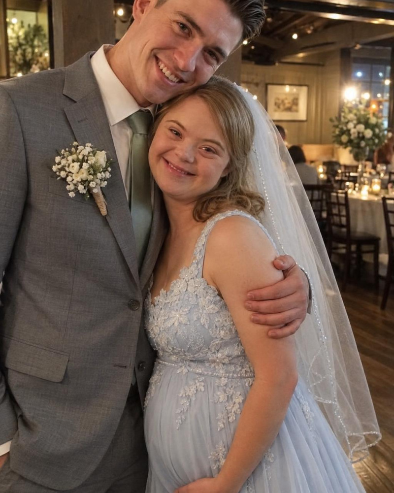 Il a épousé sa meilleure amie atteinte de trisomie 21 : la vérité cachée derrière ce mariage a tout changé