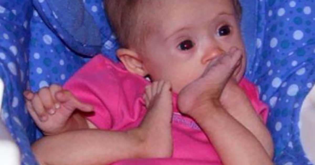 « On avait proposé à cette femme d’abandonner sa fille, mais elle a tenu bon. » Regardez ce qu’elle est devenue aujourd’hui !