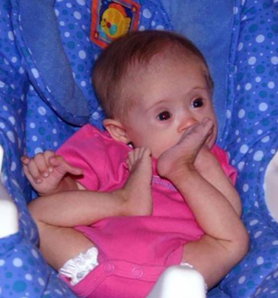 « On avait proposé à cette femme d’abandonner sa fille, mais elle a tenu bon. » Regardez ce qu’elle est devenue aujourd’hui !