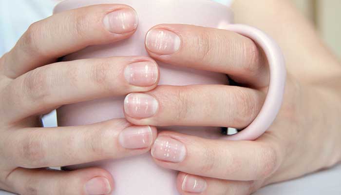 Santé : ces mystérieuses stries sur vos ongles qui en disent long sur votre corps