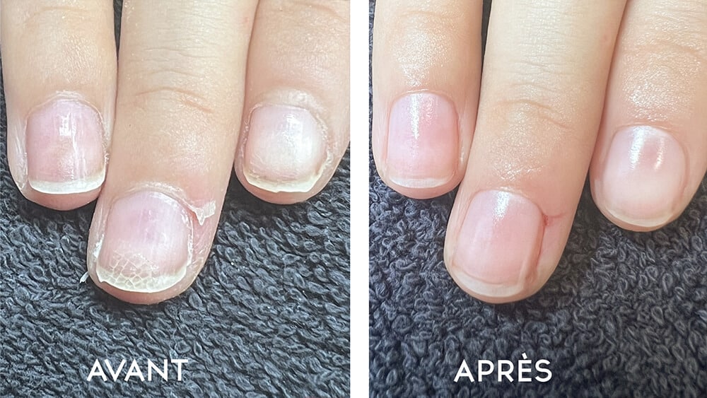 Vaseline et citron : l’alliance surprenante qui révolutionne vos soins beauté