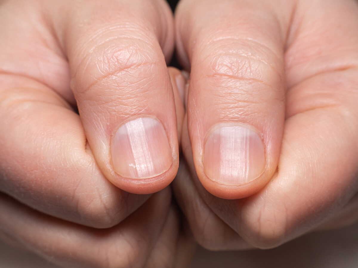 Stries sur les ongles : ce que ces fines lignes révèlent vraiment sur votre santé