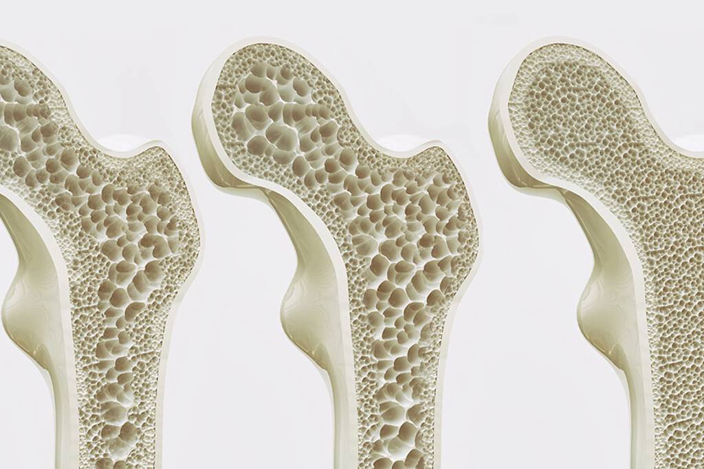 Os et jambes douloureux : et si une carence en vitamine était la cause cachée de vos maux ?