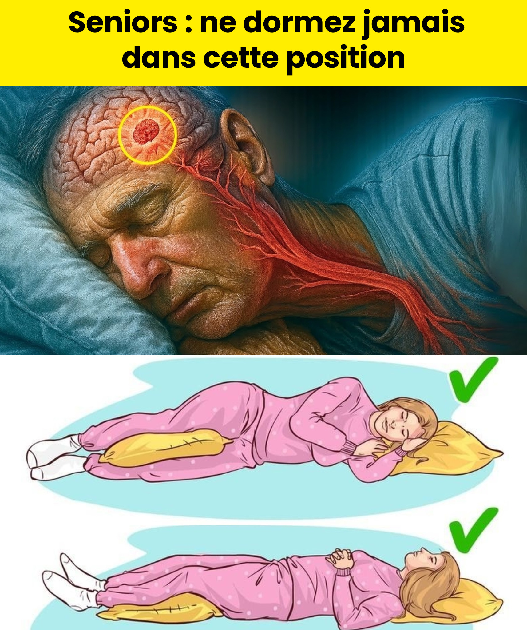 Personnes âgées : cette position de sommeil augmente le risque d’AVC