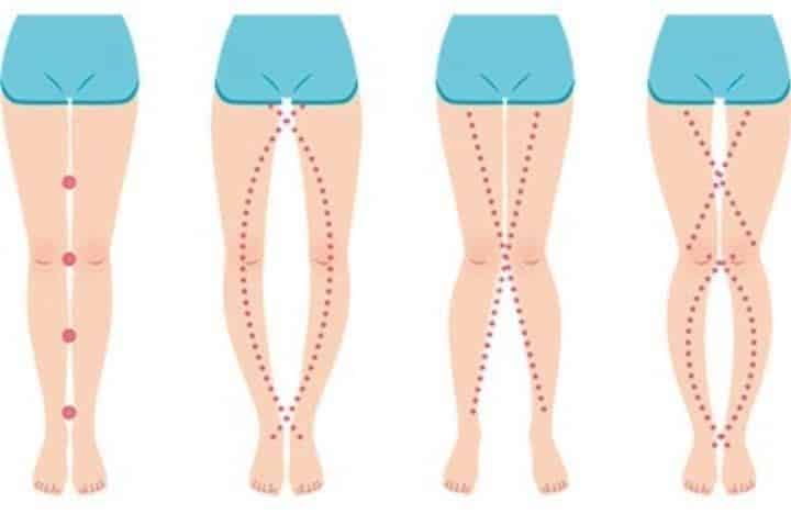 Femme observant ses jambes