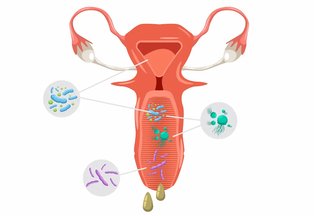 Odeur de poisson dans la zone intime : quand votre flore vaginale tire la sonnette d’alarme
