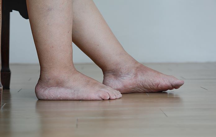 Ces 9 changements sur vos pieds que votre foie n’arrive plus à vous cacher