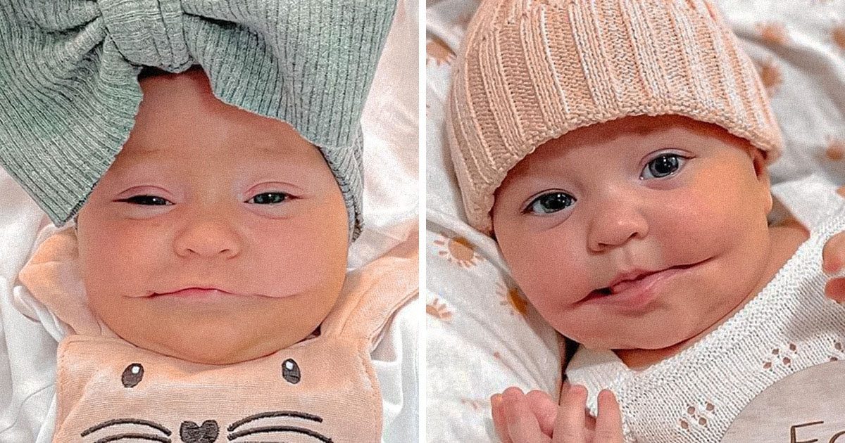 Plongez dans le récit touchant d’Ayla, ce bébé venu au monde avec un sourire hors du commun