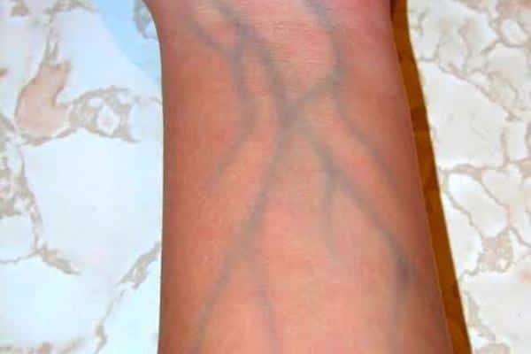 Ces veines apparentes sur vos mains : faut-il vraiment s'en alarmer ?