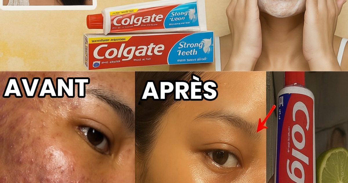 Pourquoi l’astuce du Colgate et citron fait tant parler d’elle ?