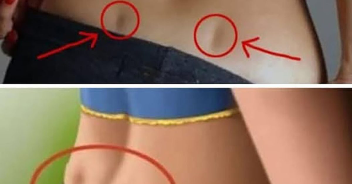 Que signifie la présence de deux fossettes dans le bas du dos ?