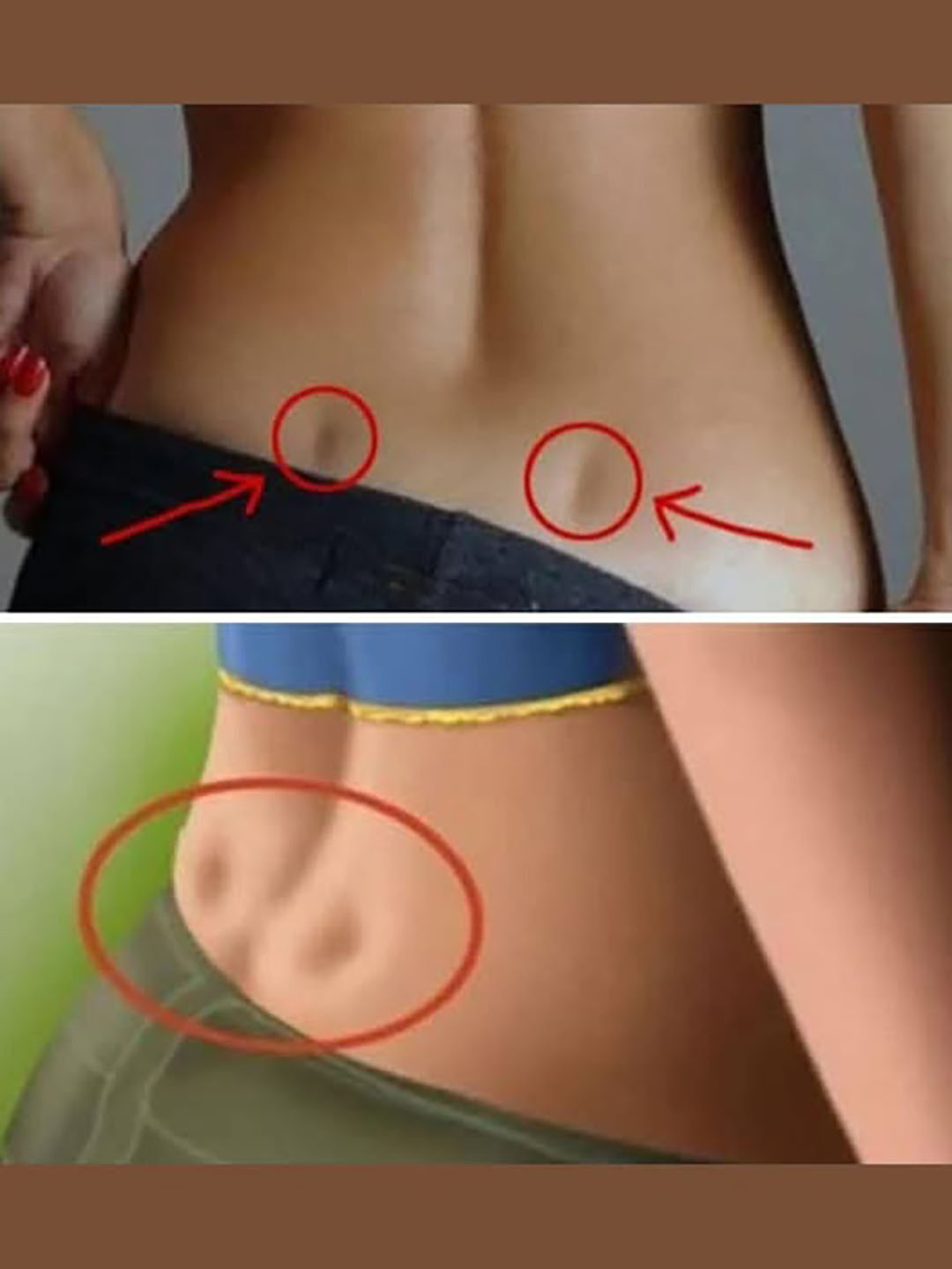 Que signifie la présence de deux fossettes dans le bas du dos ?