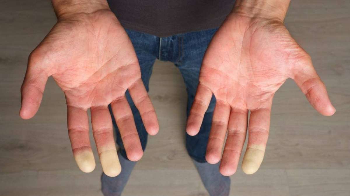 Pourquoi un doigt devient soudainement blanc sous l’effet du froid : l’explication surprenante