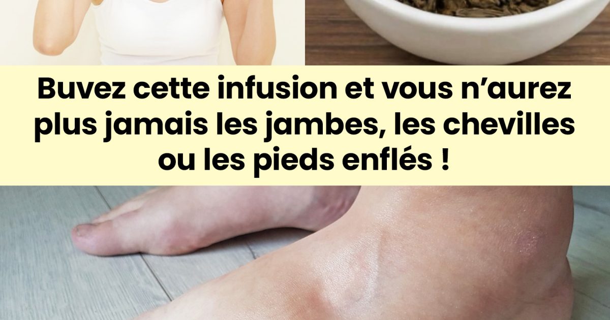 Recette : Infusion pour les jambes gonflées