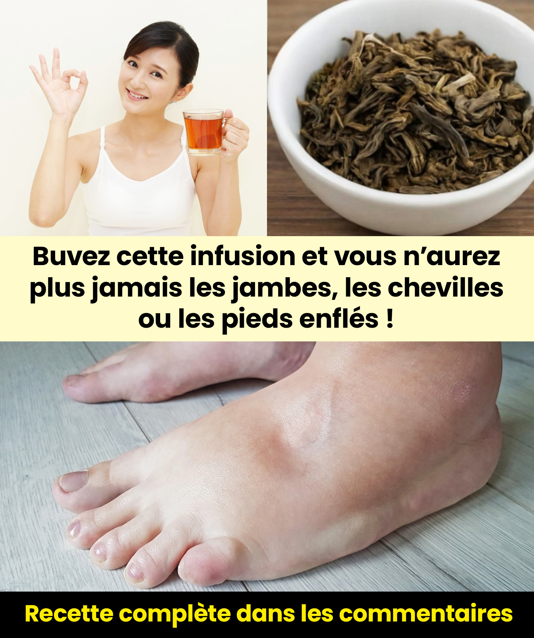 Recette : Infusion pour les jambes gonflées