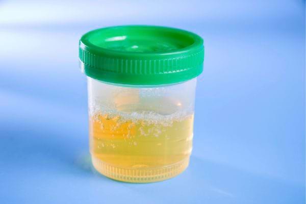 Flacon d'analyse d'urine suspendu