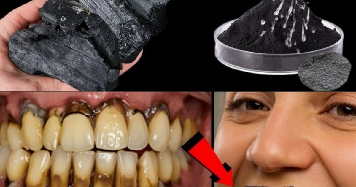 Renforcez vos dents et votre sourire grâce à ces astuces naturelles