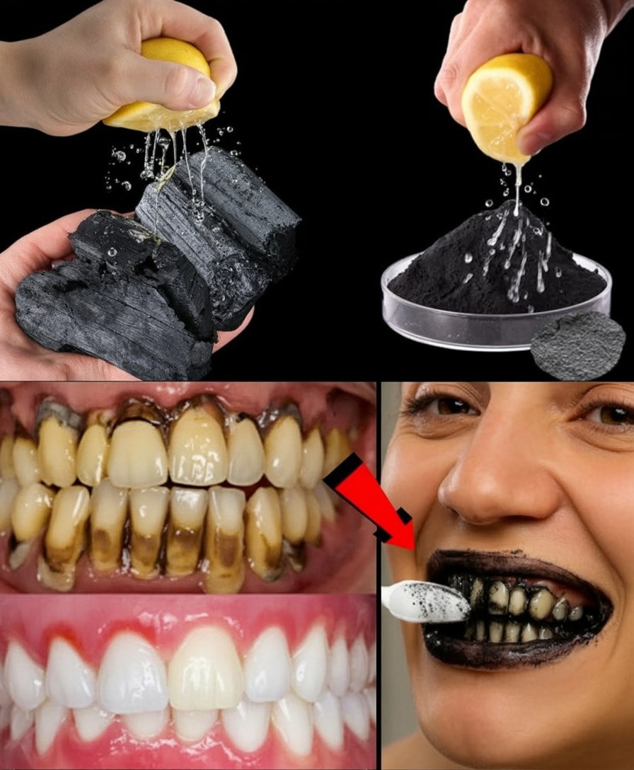 Renforcez vos dents et votre sourire grâce à ces astuces naturelles