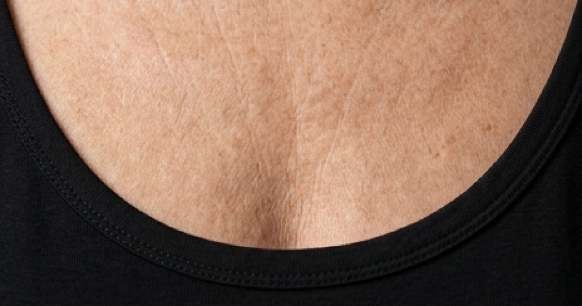 Rides du décolleté : 5 conseils pour les prévenir et en améliorer l’apparence