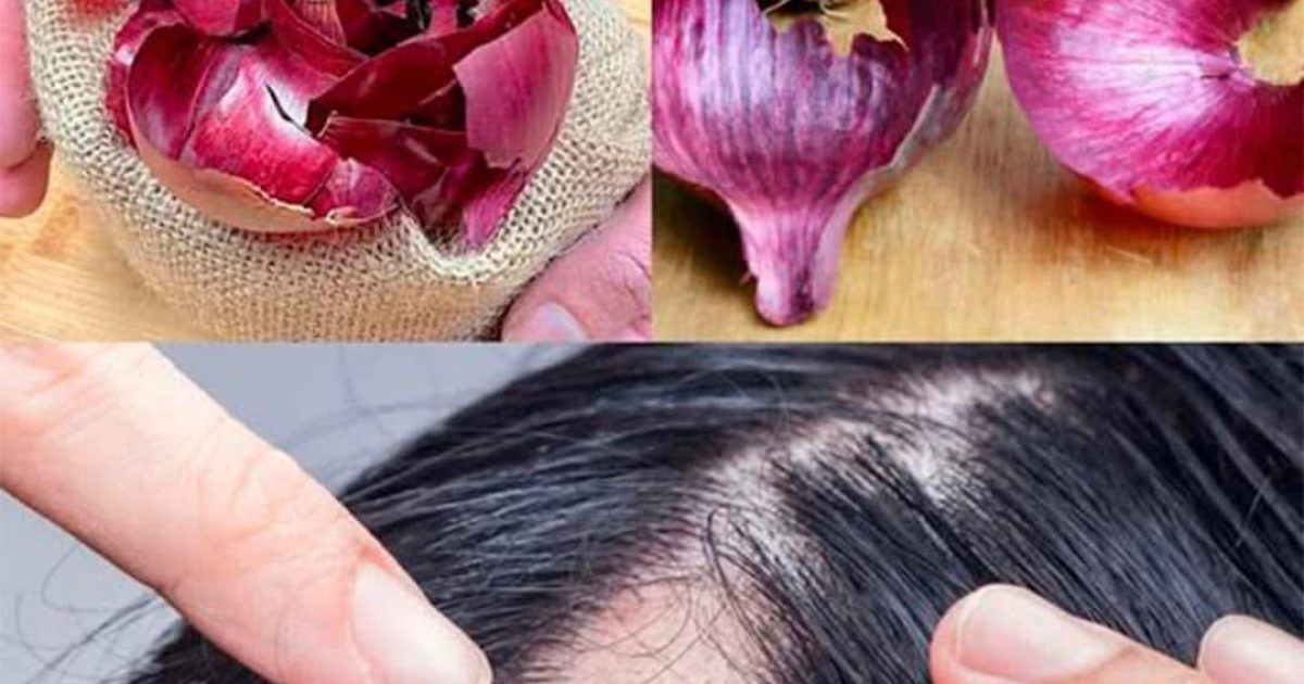 Shampoing à l’oignon : ses multiples bienfaits