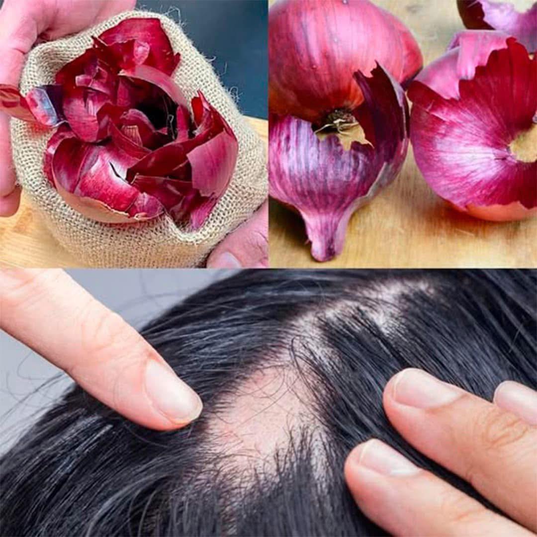 Shampoing à l’oignon : ses multiples bienfaits