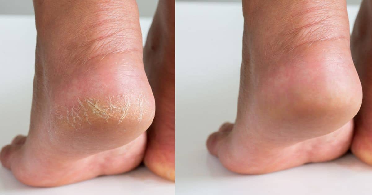 Vaseline et citron : l’alliance surprenante qui révolutionne vos soins beauté