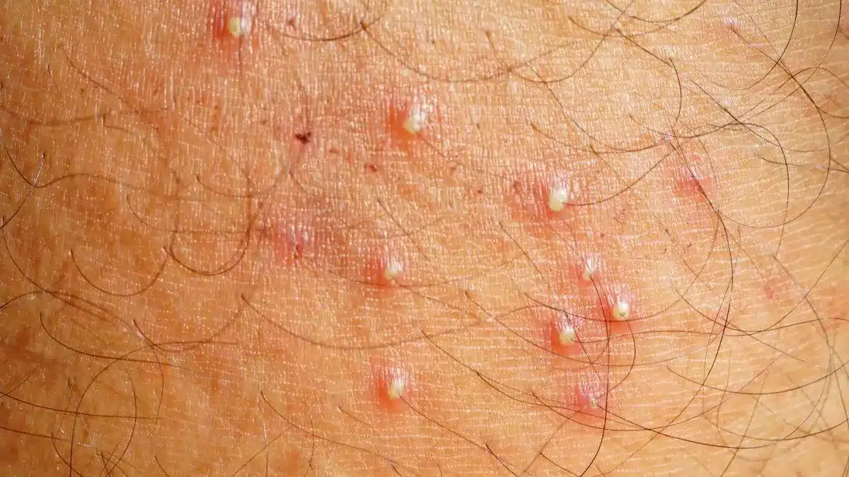 Petits points rouges sur la peau : ce que votre corps essaie vraiment de vous dire