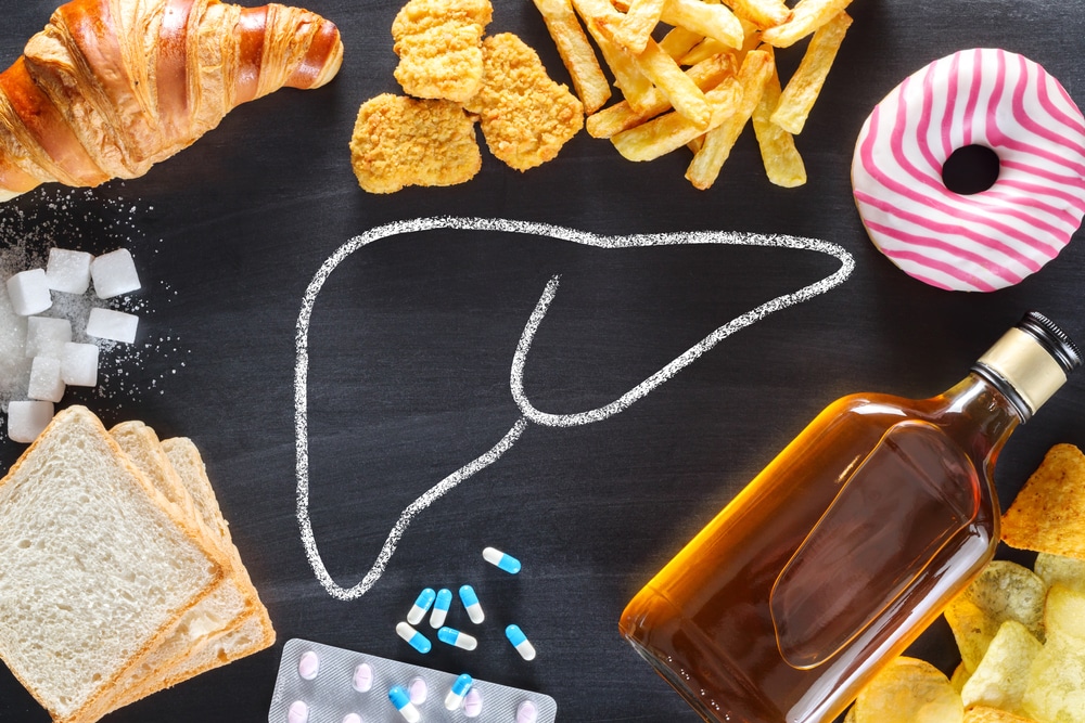 Aliments gras et sucrés représentant un danger pour le foie