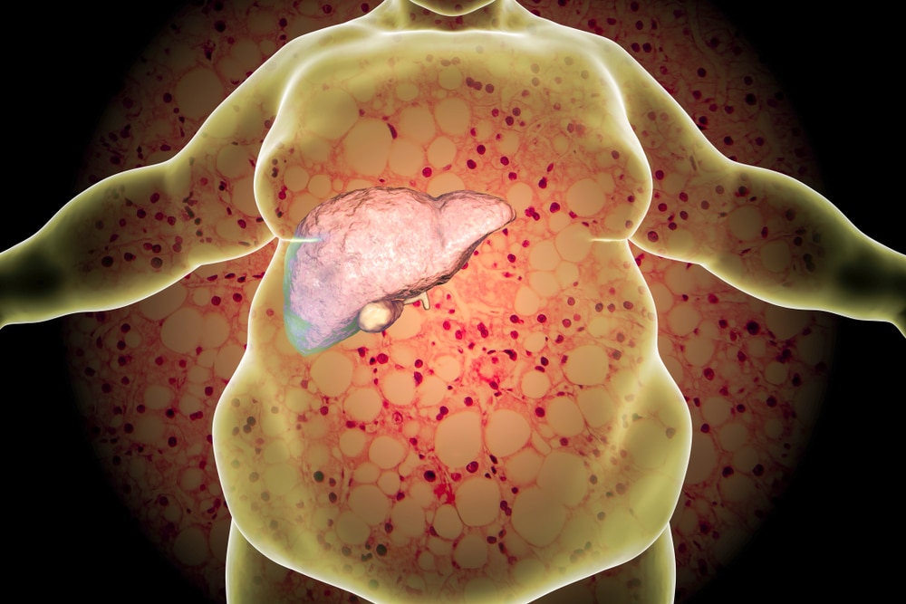 Personne se tenant le côté droit de l'abdomen